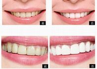 Sistema privado do descoramento do dente dos produtos dos cuidados pessoais do logotipo para clarear home dos dentes